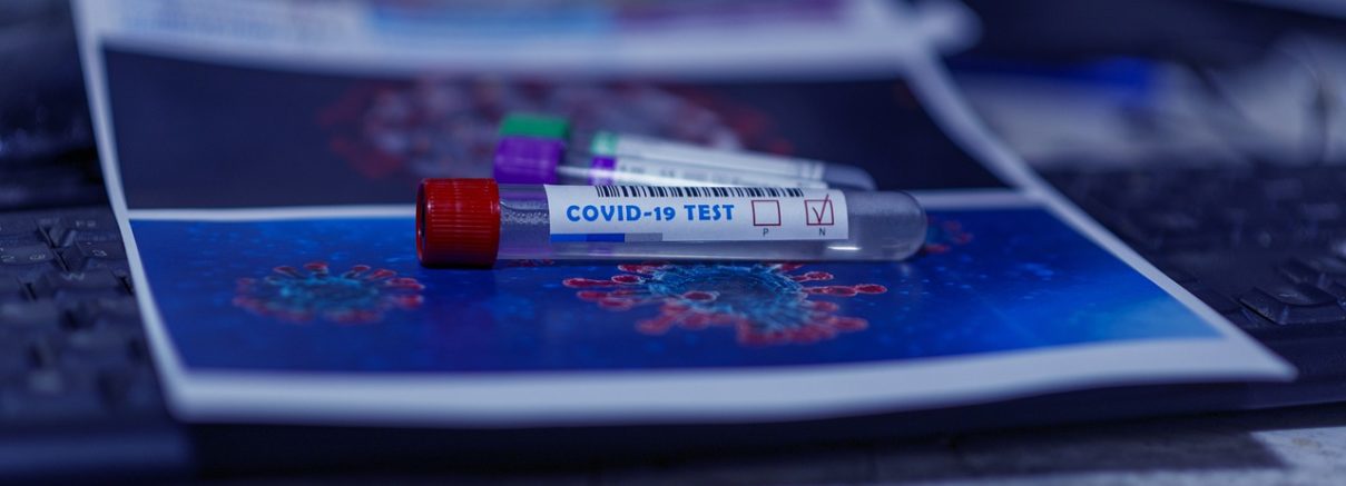 COVID-19 Antibody Tests Are Still A Work In Progress