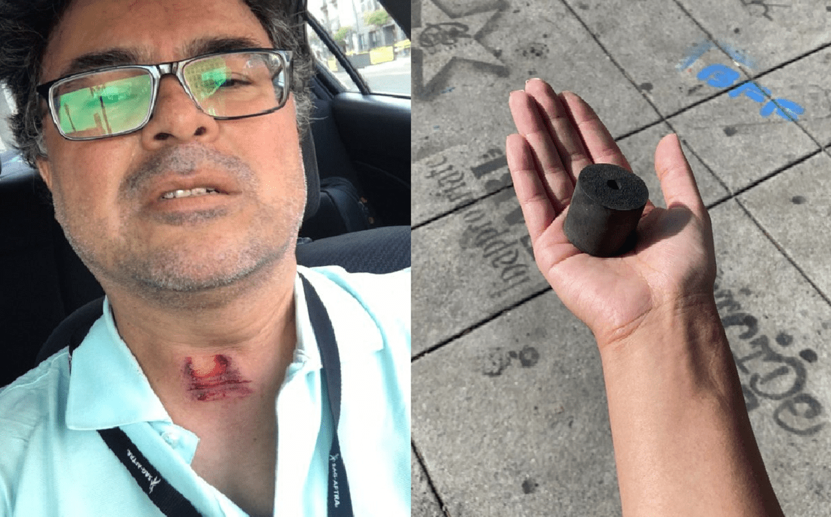 Police Using Rubber Bullets On Protesters That Can Kill