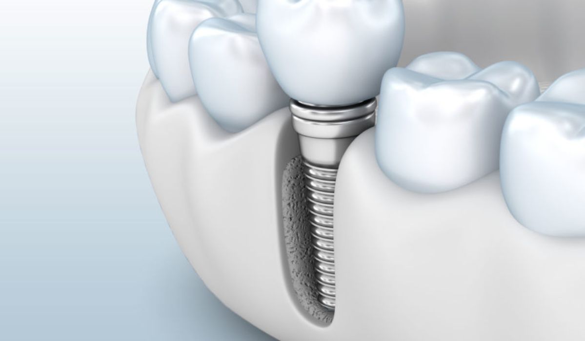 Bone Morphogenetic Protein Market