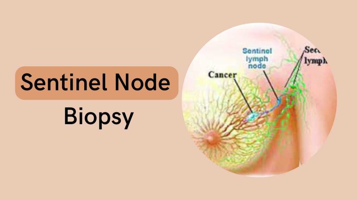 Sentinel Node Biopsy Market